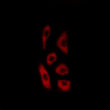 ACOT12 Antibody