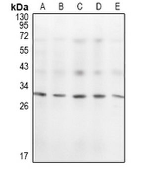 KCHIP1 Antibody