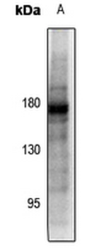 PDGFR beta (pY857) Antibody