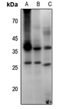 Aquaporin 2 (pS256) Antibody
