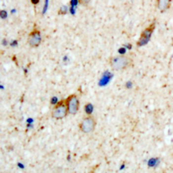 Aquaporin 2 (pS256) Antibody