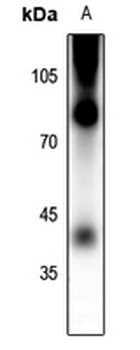 Rhodopsin (pS334) Antibody
