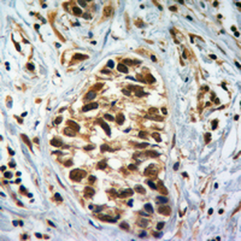 Histone H4 (MonoMethyl-K5) Antibody