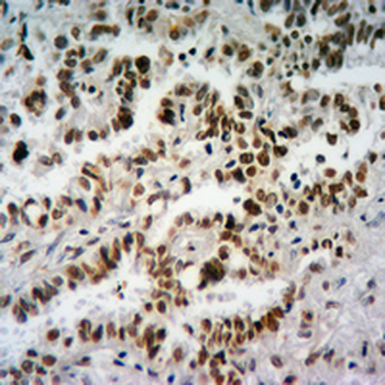 Histone H3 (TriMethyl-K26) Antibody