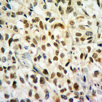Histone H2B (Butyryl-K20) Antibody
