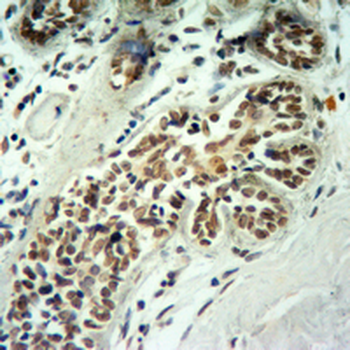 Histone H2B (Butyryl-K5) Antibody