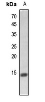 Histone H2A (Butyryl-K5) Antibody