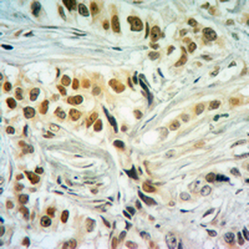 Histone H2A (Butyryl-K5) Antibody