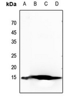 Histone H2B (AcK20) Antibody