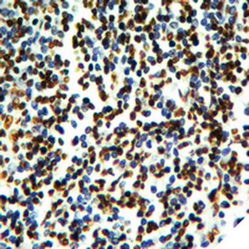 Histone H2B (AcK20) Antibody