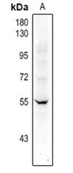 Factor XI HC Antibody