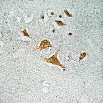 CDK5RAP1 Antibody