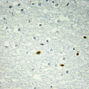 LMO4 Antibody