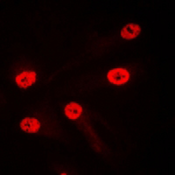 LMO4 Antibody