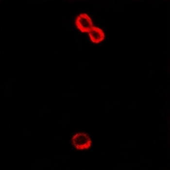 Alpha-2B Adrenergic Receptor Antibody