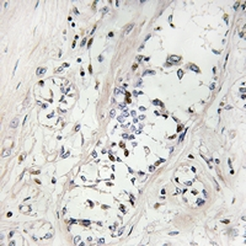 ZNF23 Antibody