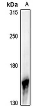 NGK Antibody