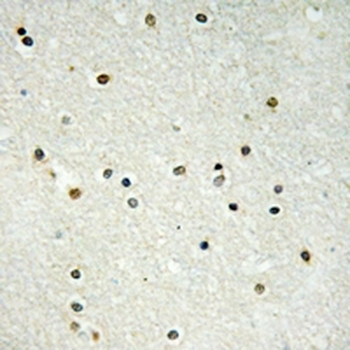 CBX6 Antibody