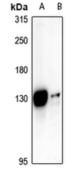 ST18 Antibody