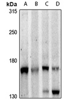PLC beta 3 Antibody