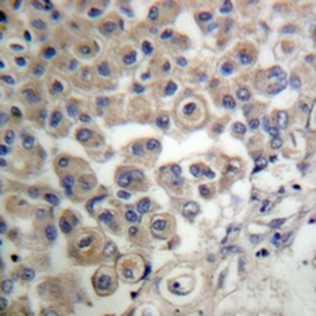 PLC beta 3 Antibody