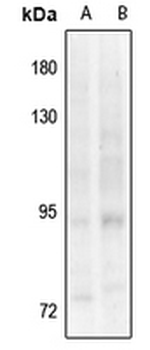 TRK B (pY817) Antibody