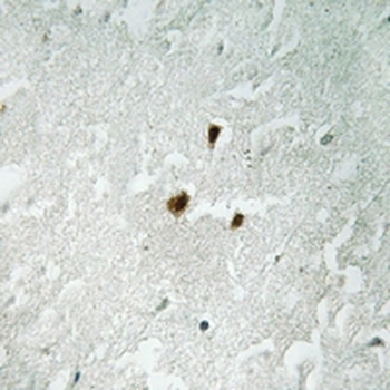 RRN3 (pS649) Antibody
