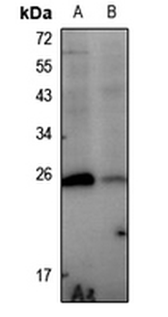 HSP27 (pS78) Antibody