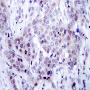 NF-kappaB p100 (pS869) Antibody