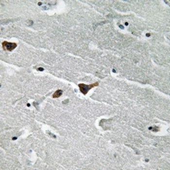 PAI1 Antibody