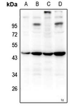 ZNF691 Antibody