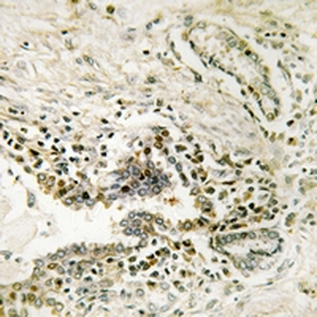 SSH3 Antibody