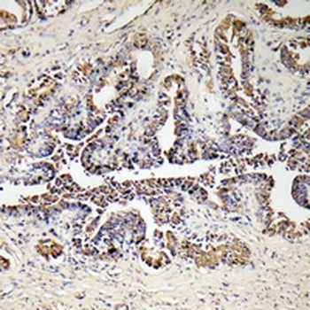 ATP5D Antibody