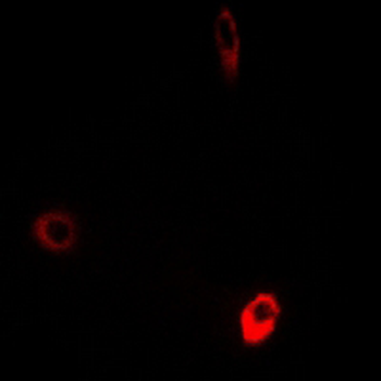 ATP5D Antibody