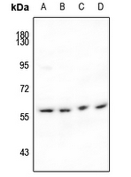 IFIT1 Antibody