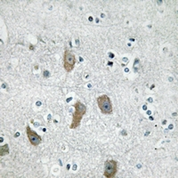 IFIT1 Antibody
