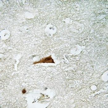 p19 INK4d Antibody