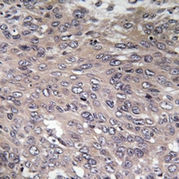 IP3R Antibody