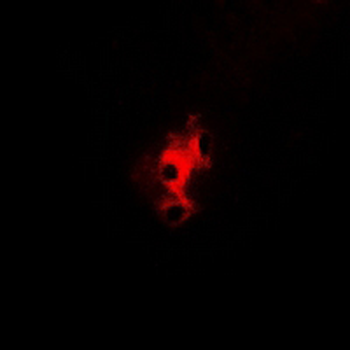 Aconitase 1 (pS138) Antibody