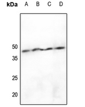hnRNP D0 (pS83) Antibody