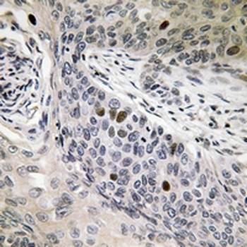 hnRNP D0 (pS83) Antibody