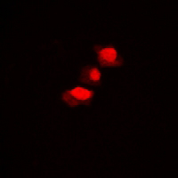 hnRNP D0 (pS83) Antibody