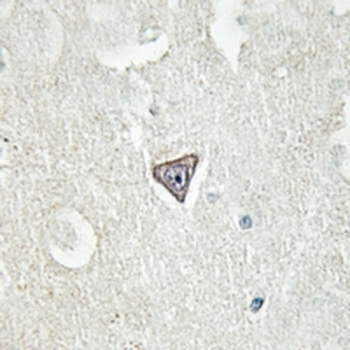 L1CAM (pS1181) Antibody