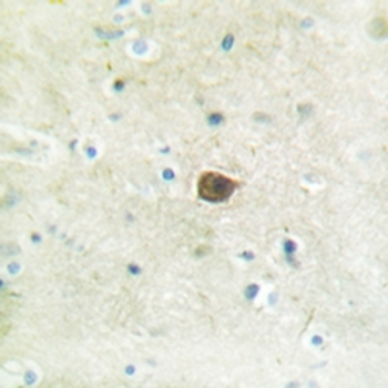 PKC mu (pS205) Antibody
