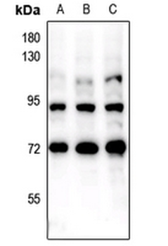FOXO1/3 (pS322+S325/pS318+S321) Antibody