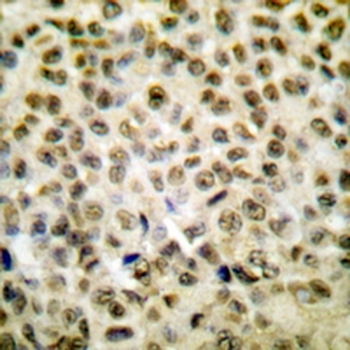 Histone H1oo (AcK163) Antibody