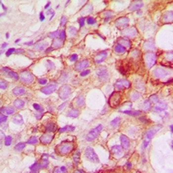 CRKL Antibody