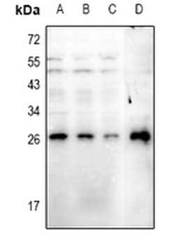 RGS19 (pS151) Antibody