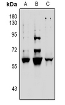 Vimentin (pS39) Antibody