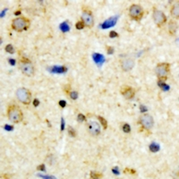Kir6.2 (pT224) Antibody